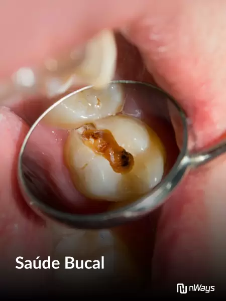 Aula-5-Saude-Bucal-ASB-Widom.jpg